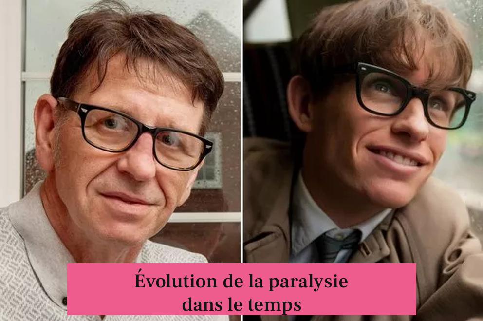 Évolution de la paralysie dans le temps