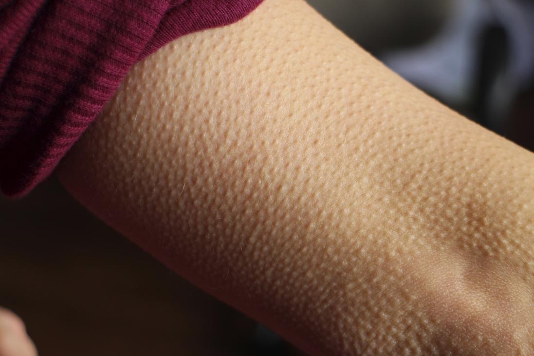 Comment les sons peuvent aussi provoquer les frissons