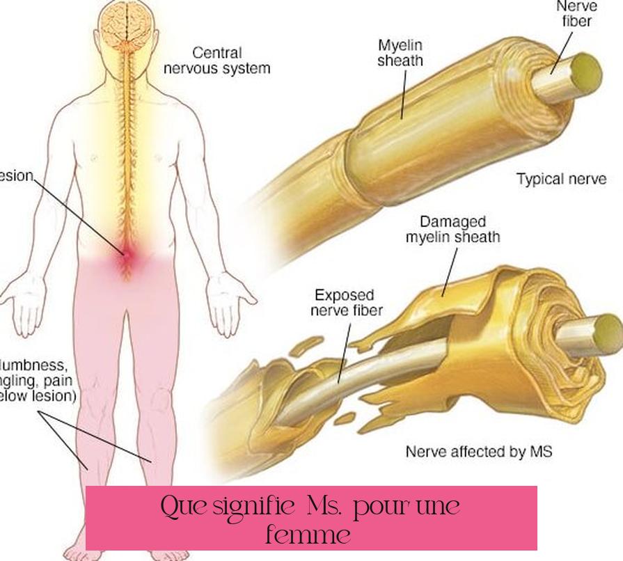 Que signifie « Ms. » pour une femme ?