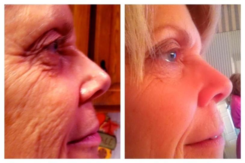 Protéger sa peau : un must absolu