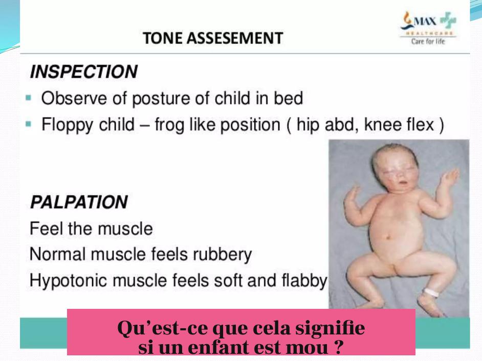 Qu’est-ce que cela signifie si un enfant est mou ?