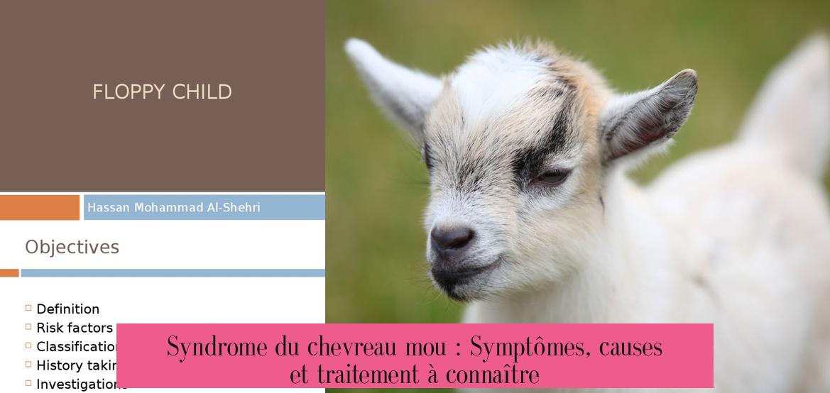 Syndrome du chevreau mou : Symptômes, causes et traitement à connaître